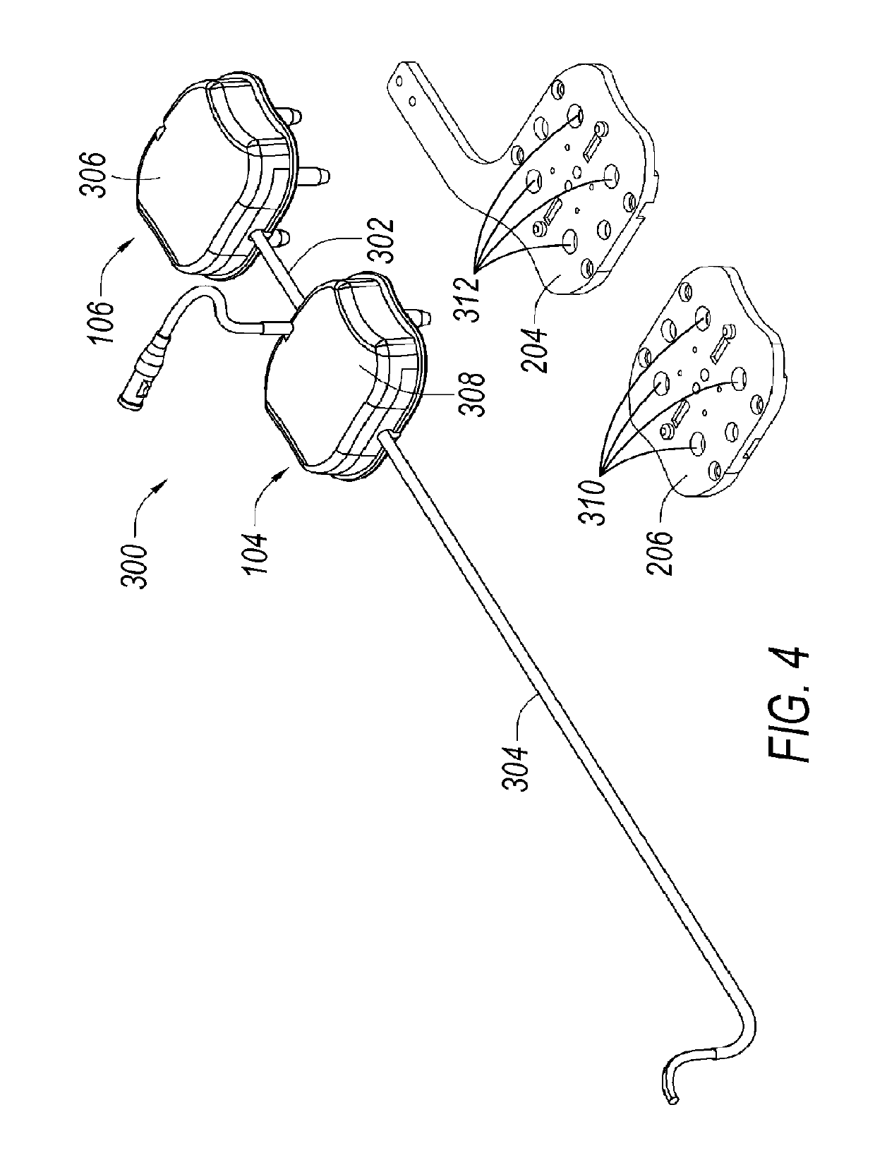 Catheter tension sensing