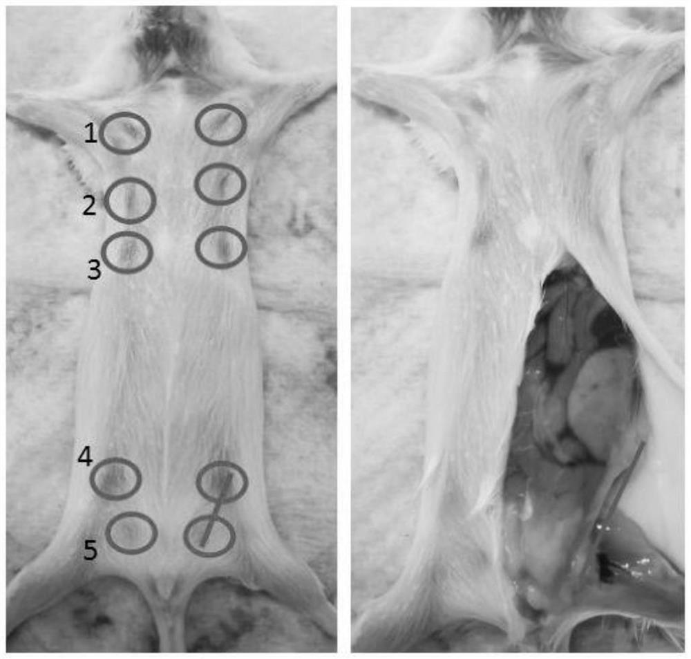 Construction method and application of breast cancer cell strain orthotopic transplantation model