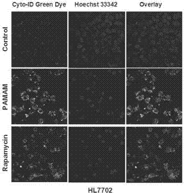 Drug composition reducing in-vivo and in-vitro toxicity of nano drug delivery material and preparation method thereof