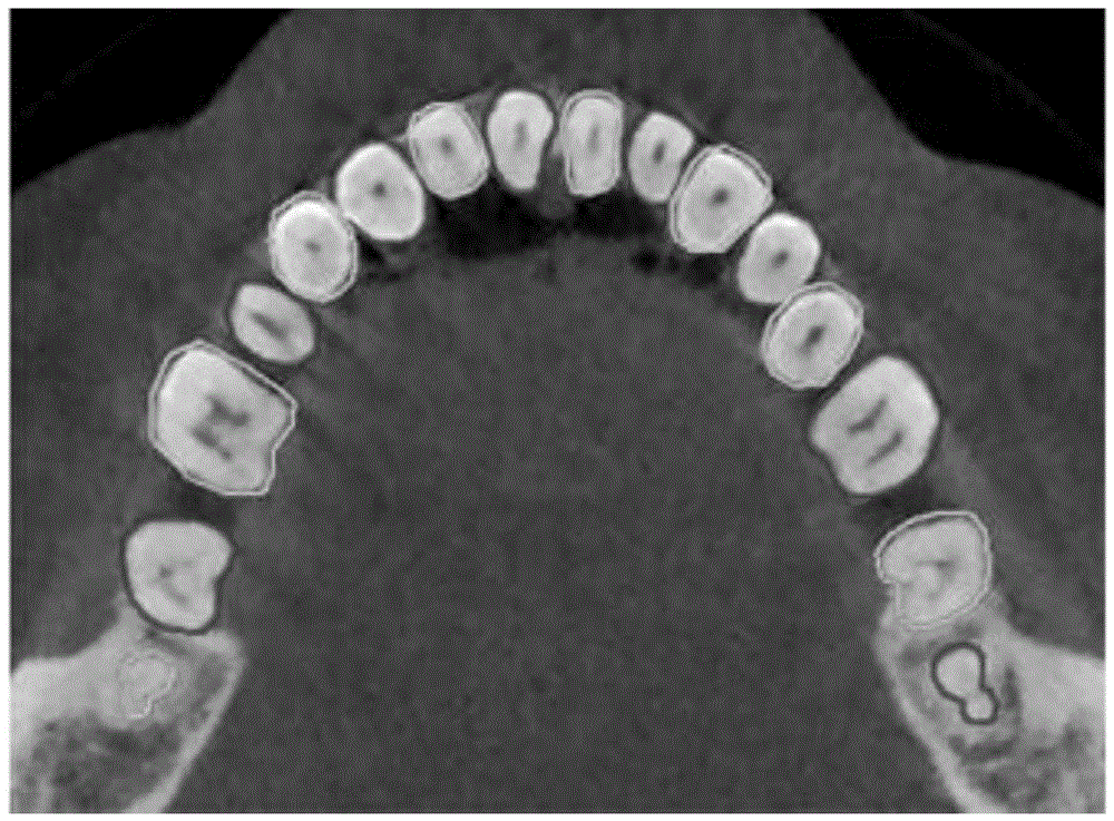 Hybrid level set based three-dimensional tooth modeling method