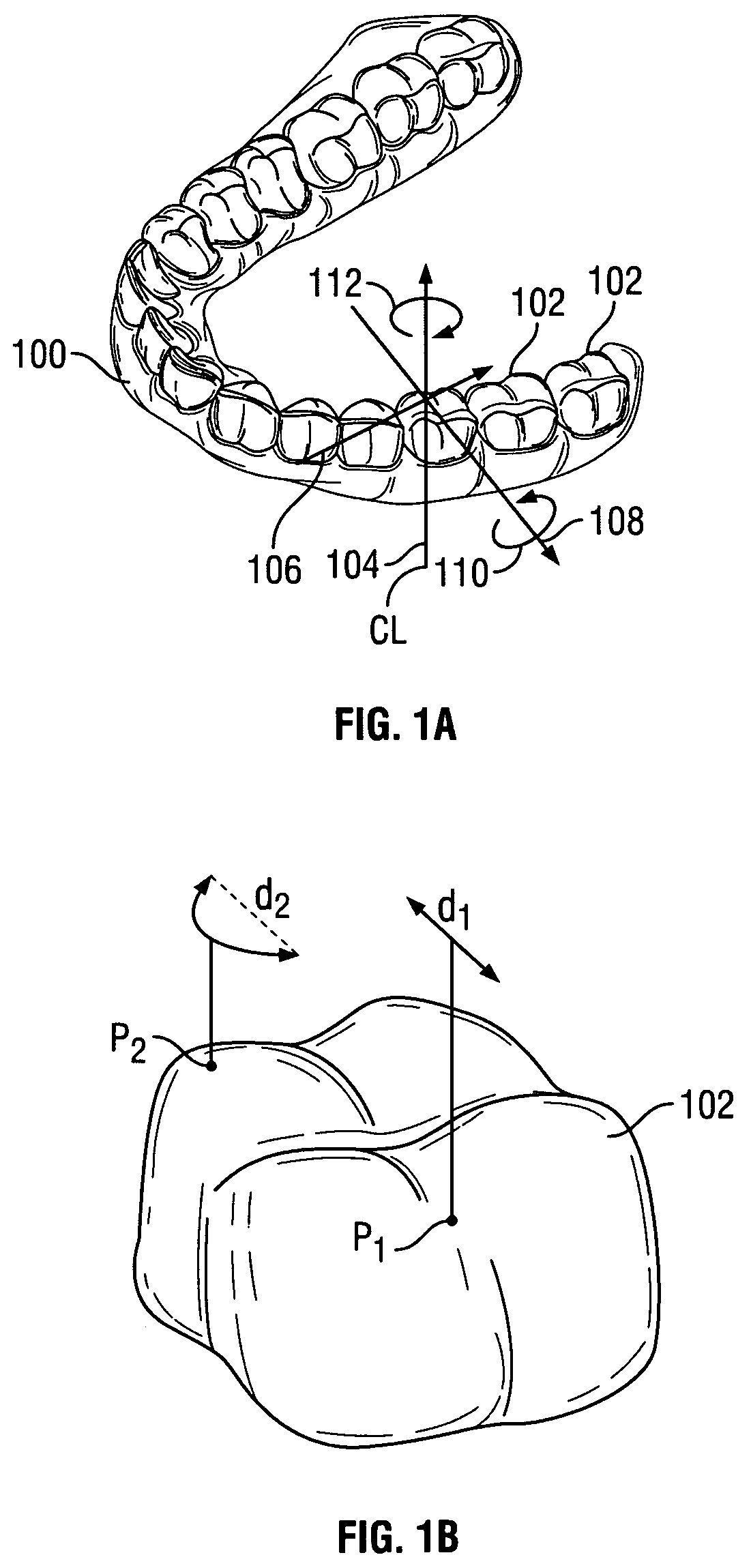 Guide apparatus and methods for making tooth positioning appliances