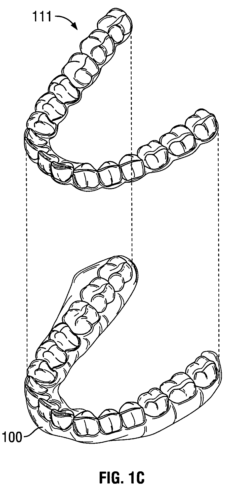 Guide apparatus and methods for making tooth positioning appliances