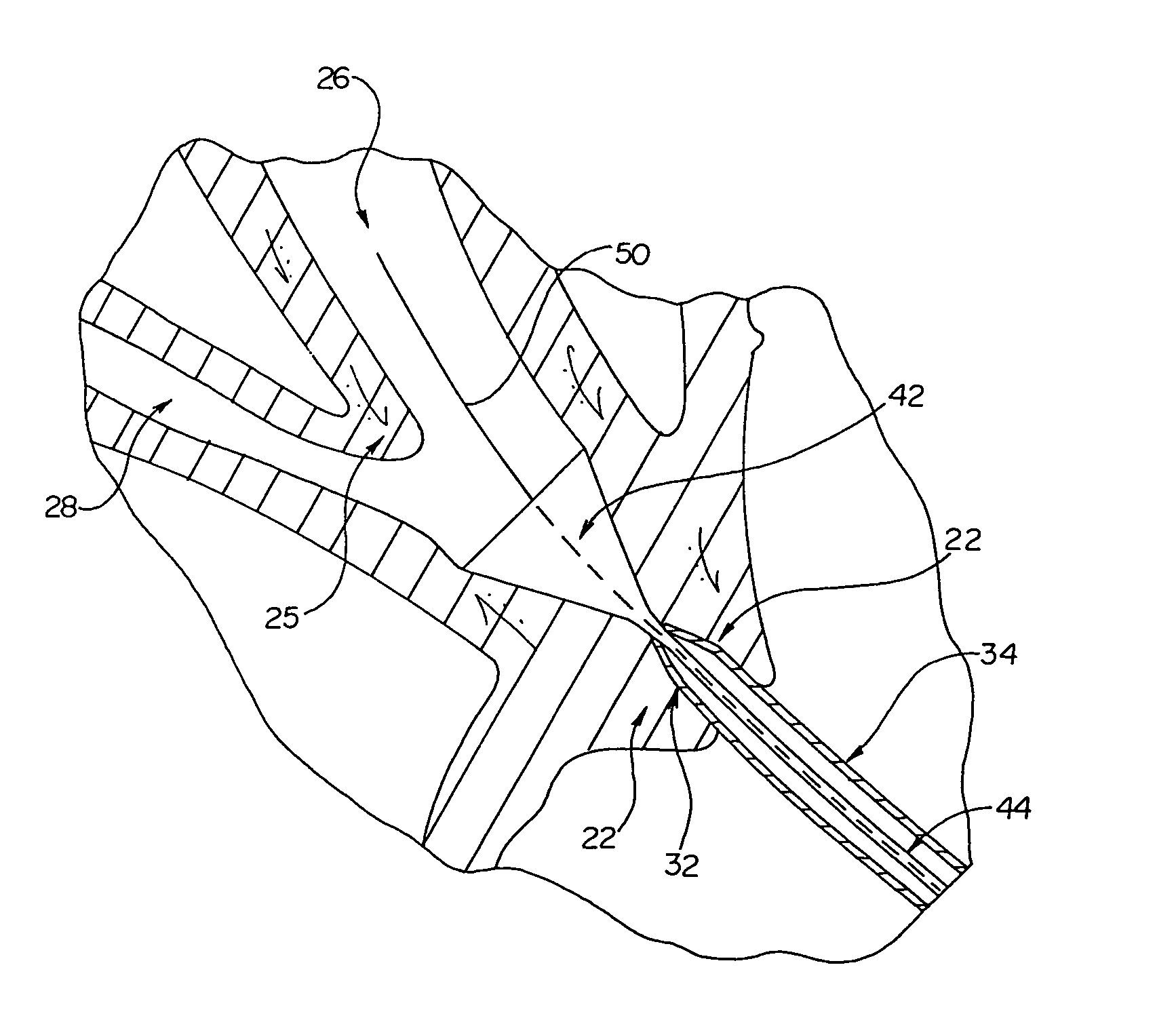 Cone tip biliary catheter and method of use