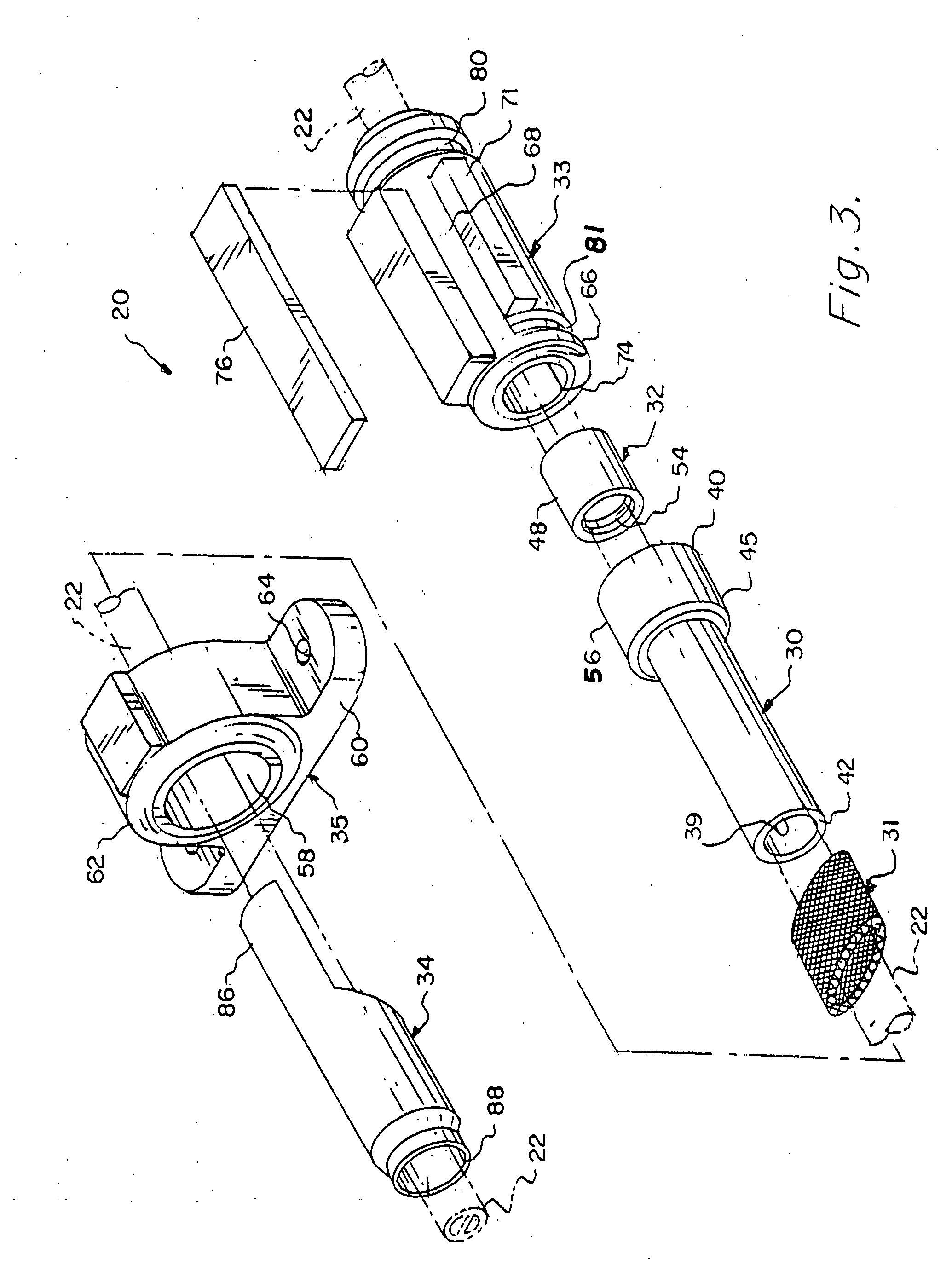 Apparatus and method for percutaneous catheter implantation and replacement