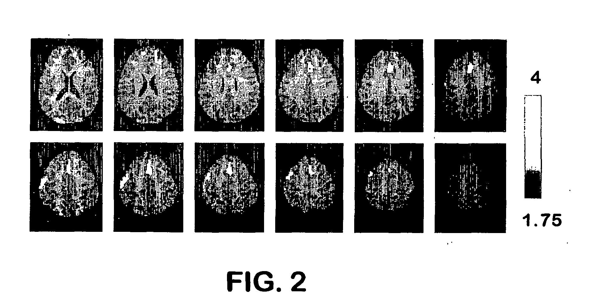 Functional brain imaging for detecting and assessing deception and concealed recognition, and cognitive/emotional response to information