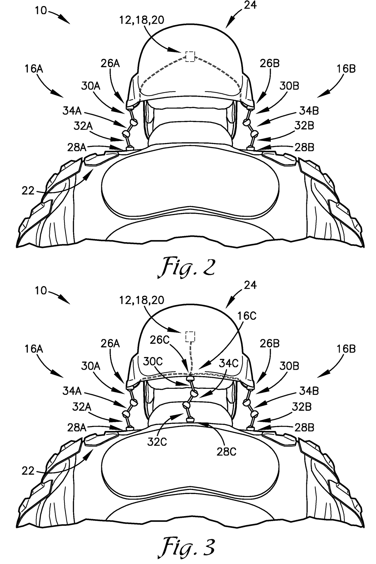 System, method, and devices for reducing concussive traumatic brain injuries
