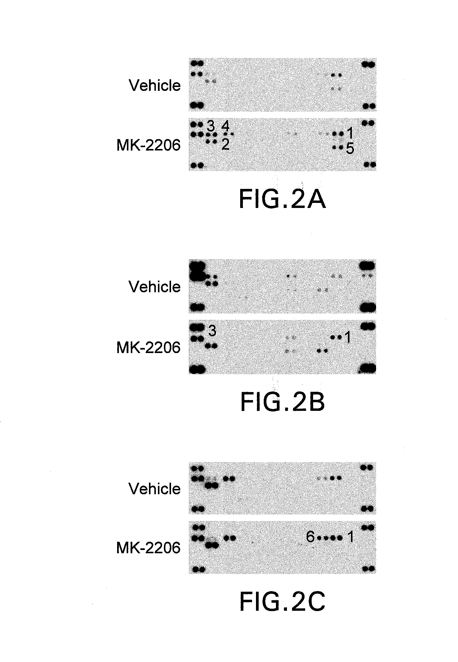 Combination therapy for treating cancer comprising an igf-1r inhibitor and an akt inhibitor