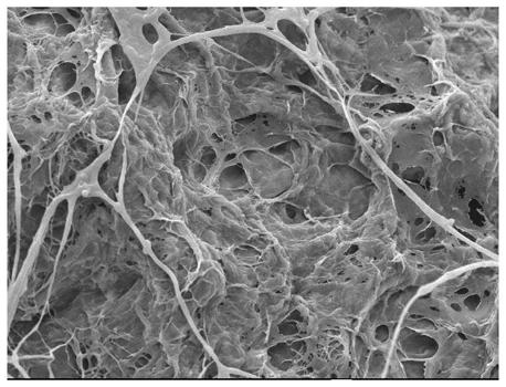 Multifunctional bone filling material containing black phosphorus nanosheets and preparation method thereof