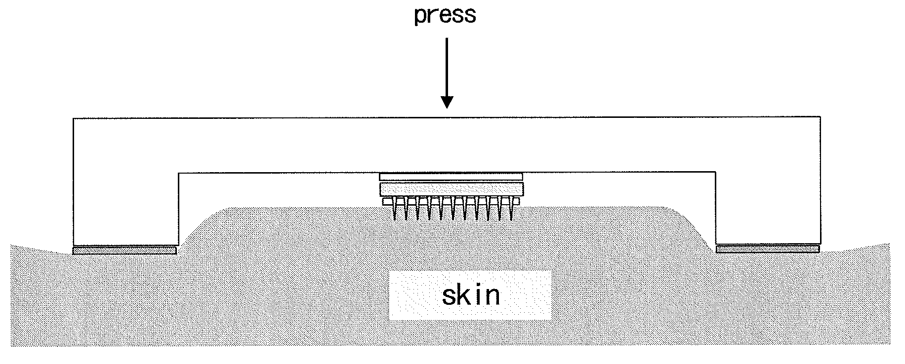 Applicator for microneedle array
