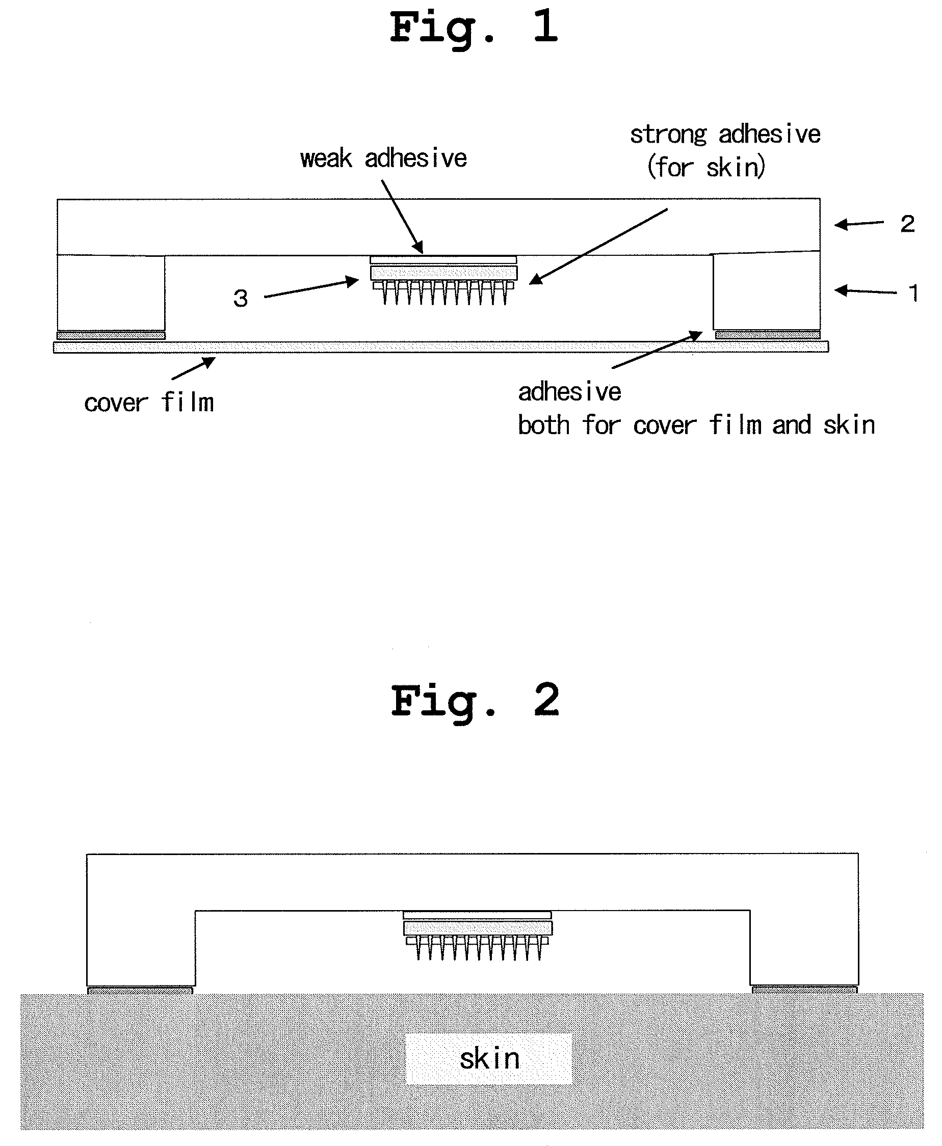 Applicator for microneedle array