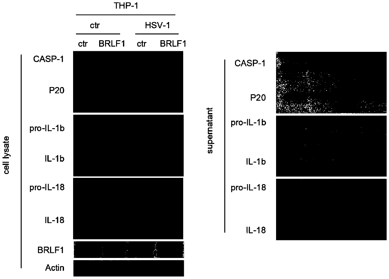 Application of EBV (Epstein-Barr virus) BRLF1 and its functional small peptide in inhibiting activity of inflammasomes
