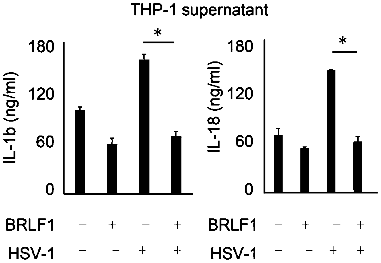 Application of EBV (Epstein-Barr virus) BRLF1 and its functional small peptide in inhibiting activity of inflammasomes