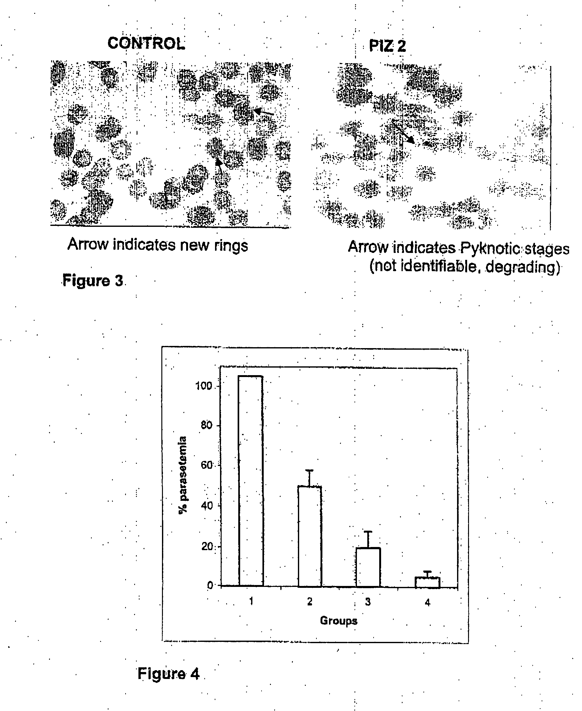 Use of selected amino acid-zinc complexes as anti-malarials