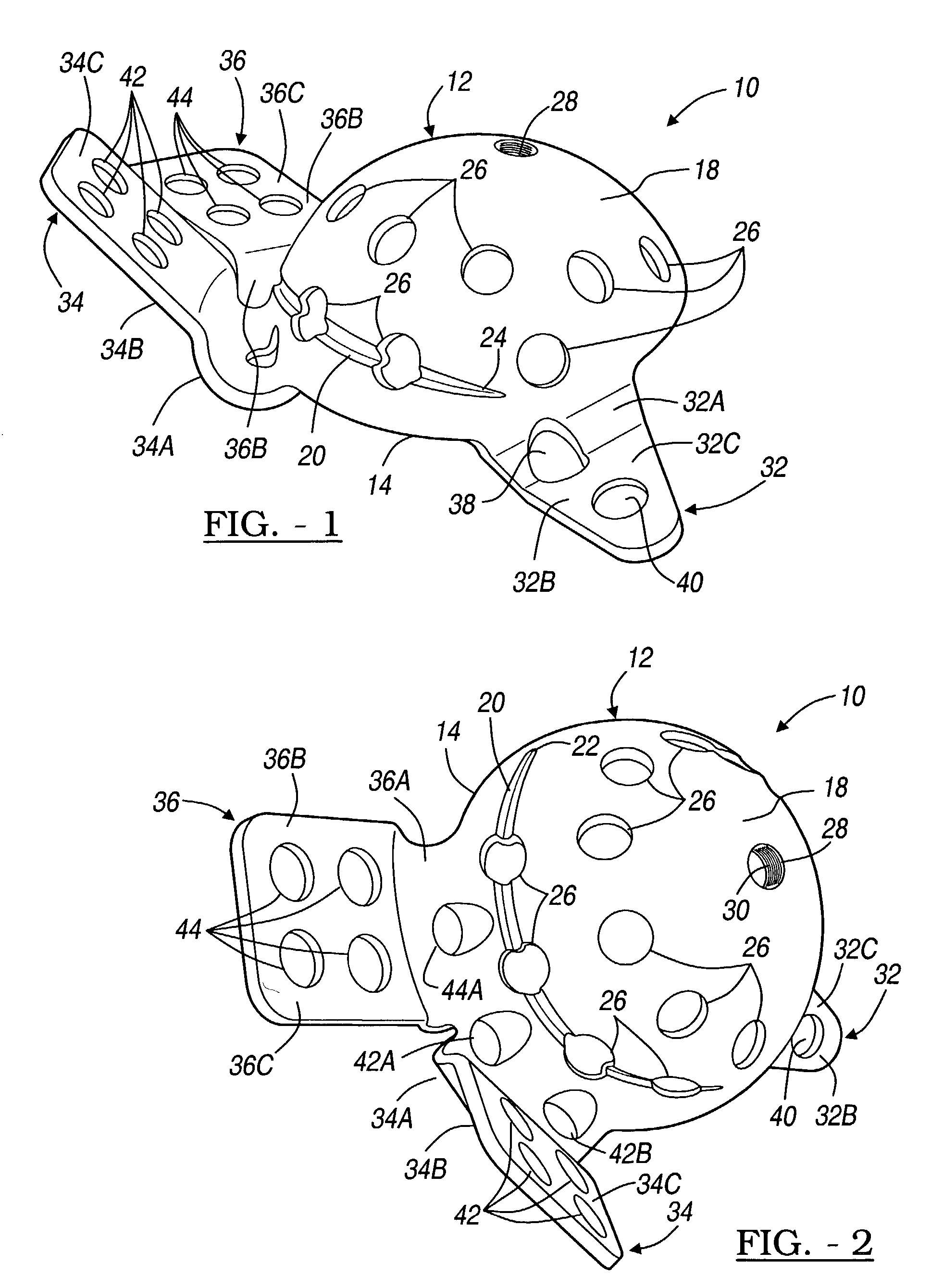 Method and apparatus for acetabular reconstruction