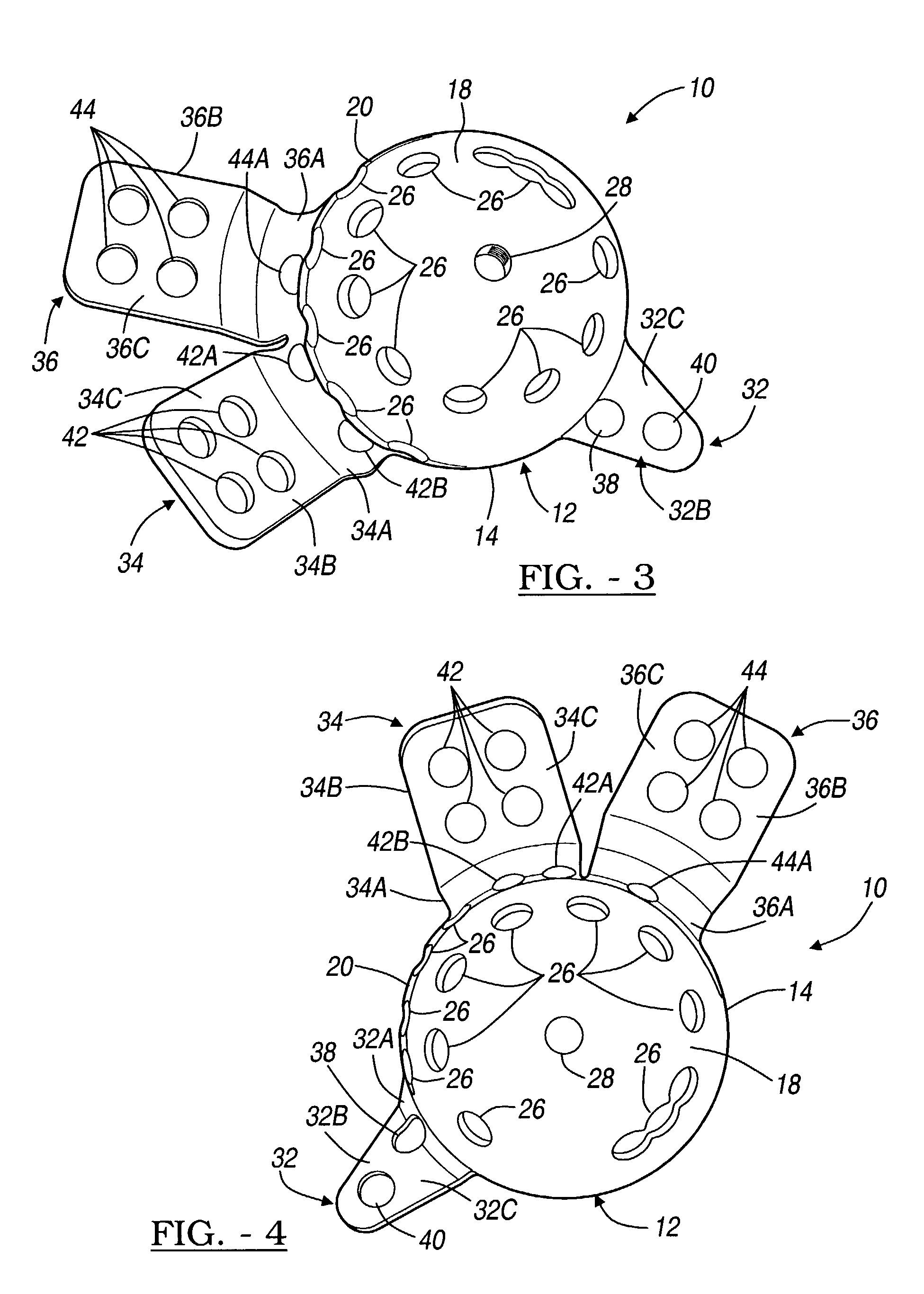 Method and apparatus for acetabular reconstruction