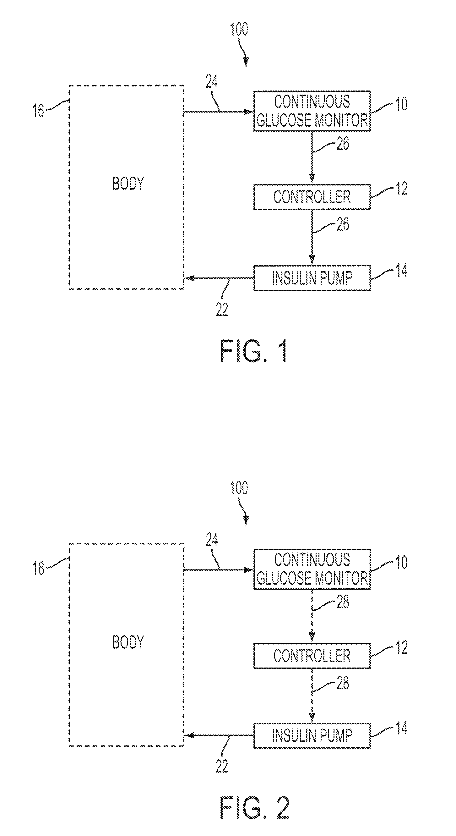 Predictive control based system and method for control of insulin delivery in diabetes using glucose sensing