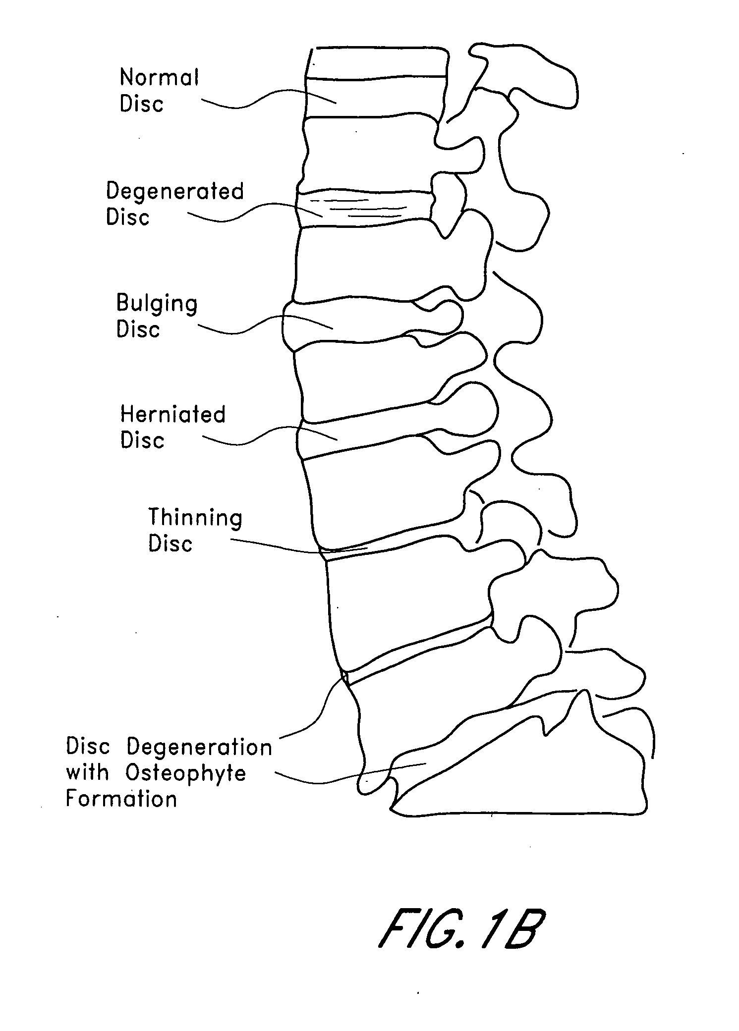 Exchange system for soft tissue access pathway