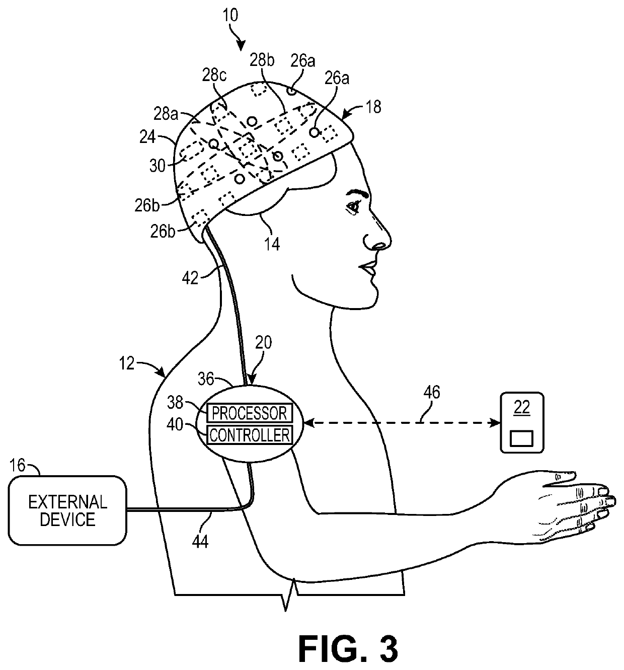 Nested and parallel feedback control loops for ultra-fine measurements of magnetic fields from the brain using a neural detection system