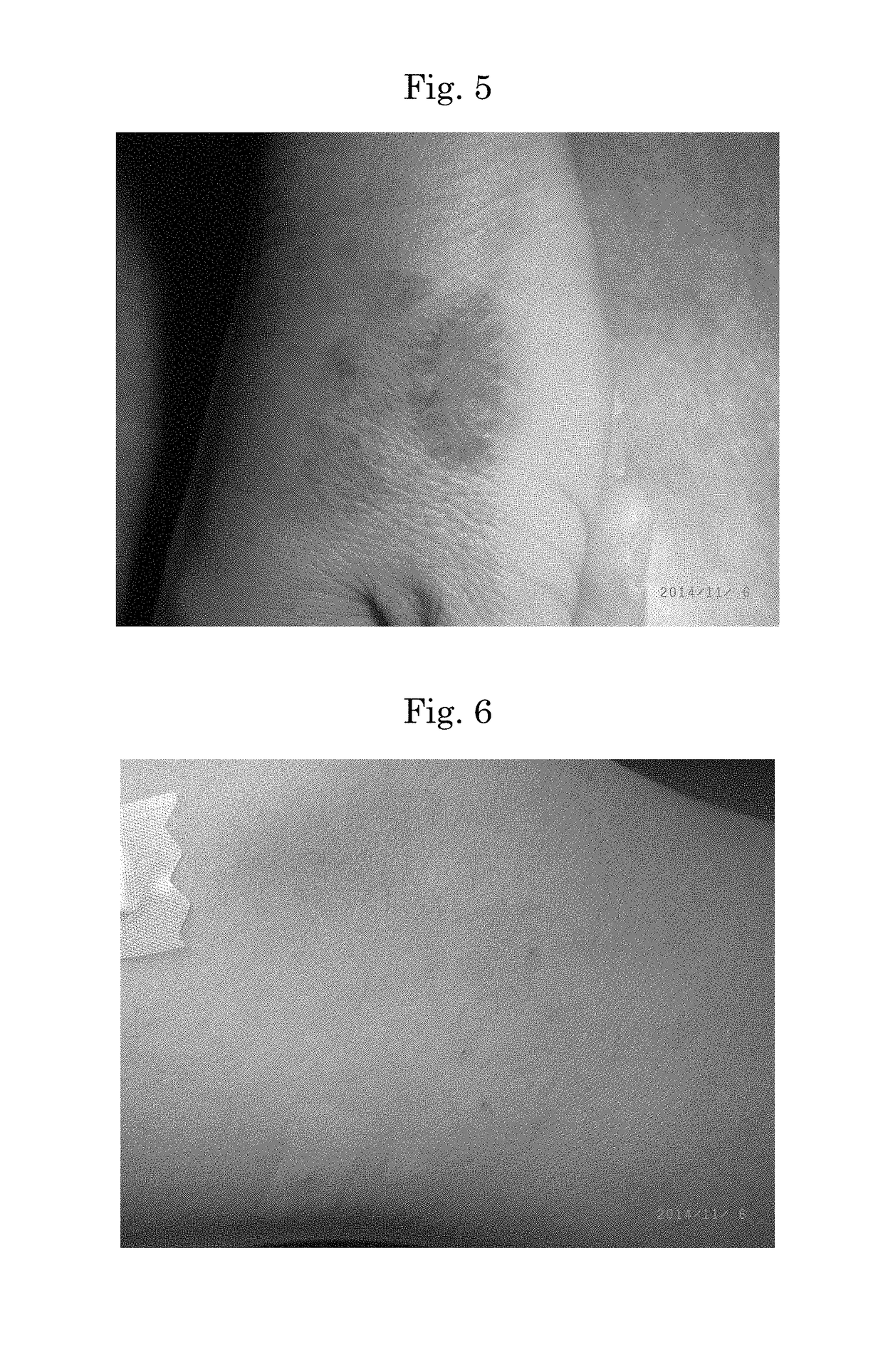 Method for coating skin abrasion, laceration, burn or oedema after surgery