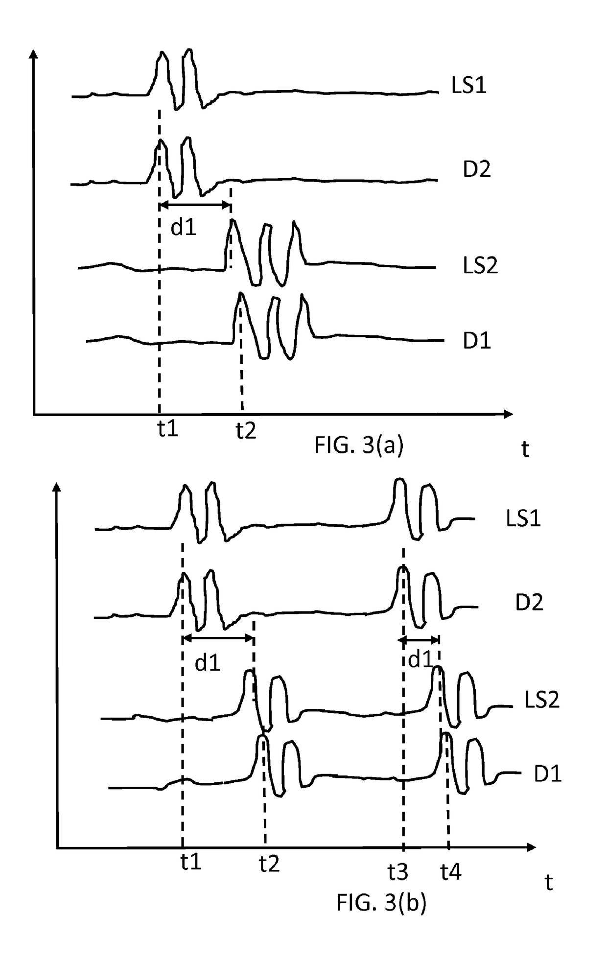 Sensor system and method which makes use of multiple ppg sensors