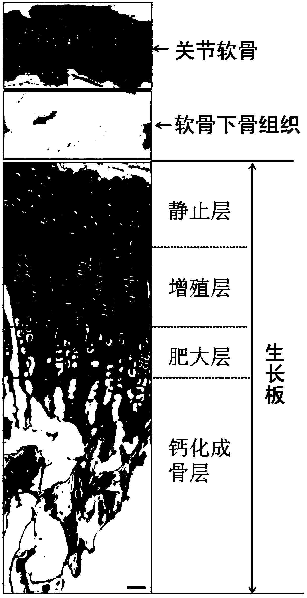 A method for constructing epiphyseal plate cartilage in vitro