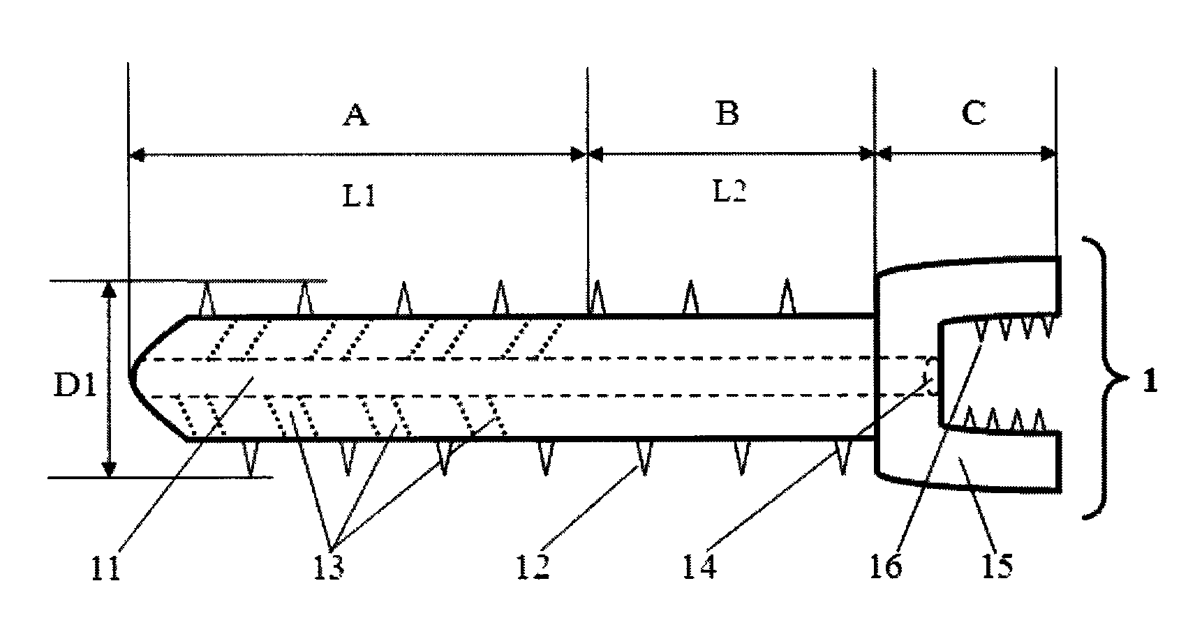 Assembly for reinforcing injectable vertebral pedicle screw