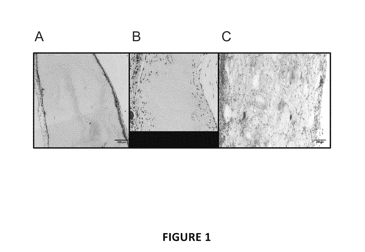 Tissue scaffold materials for tissue regeneration and methods of making
