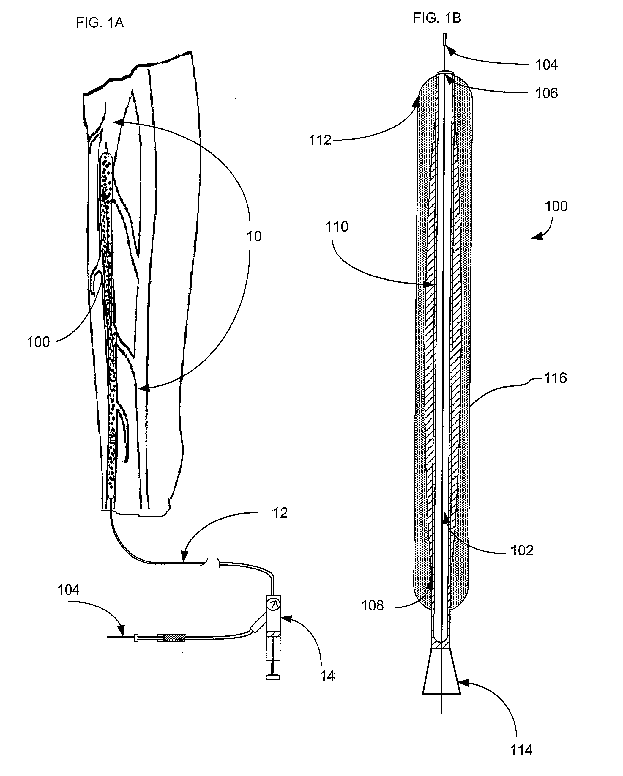 Methods and apparatus for treatment of venous insufficiency