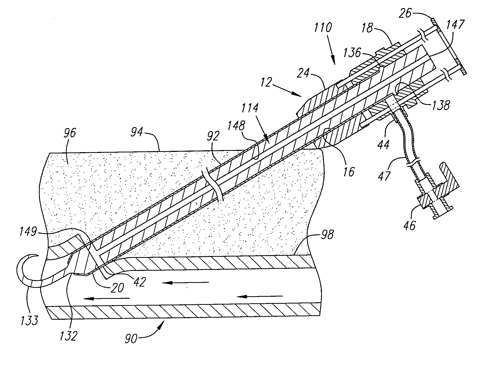 Apparatus and methods for positioning a vascular sheath