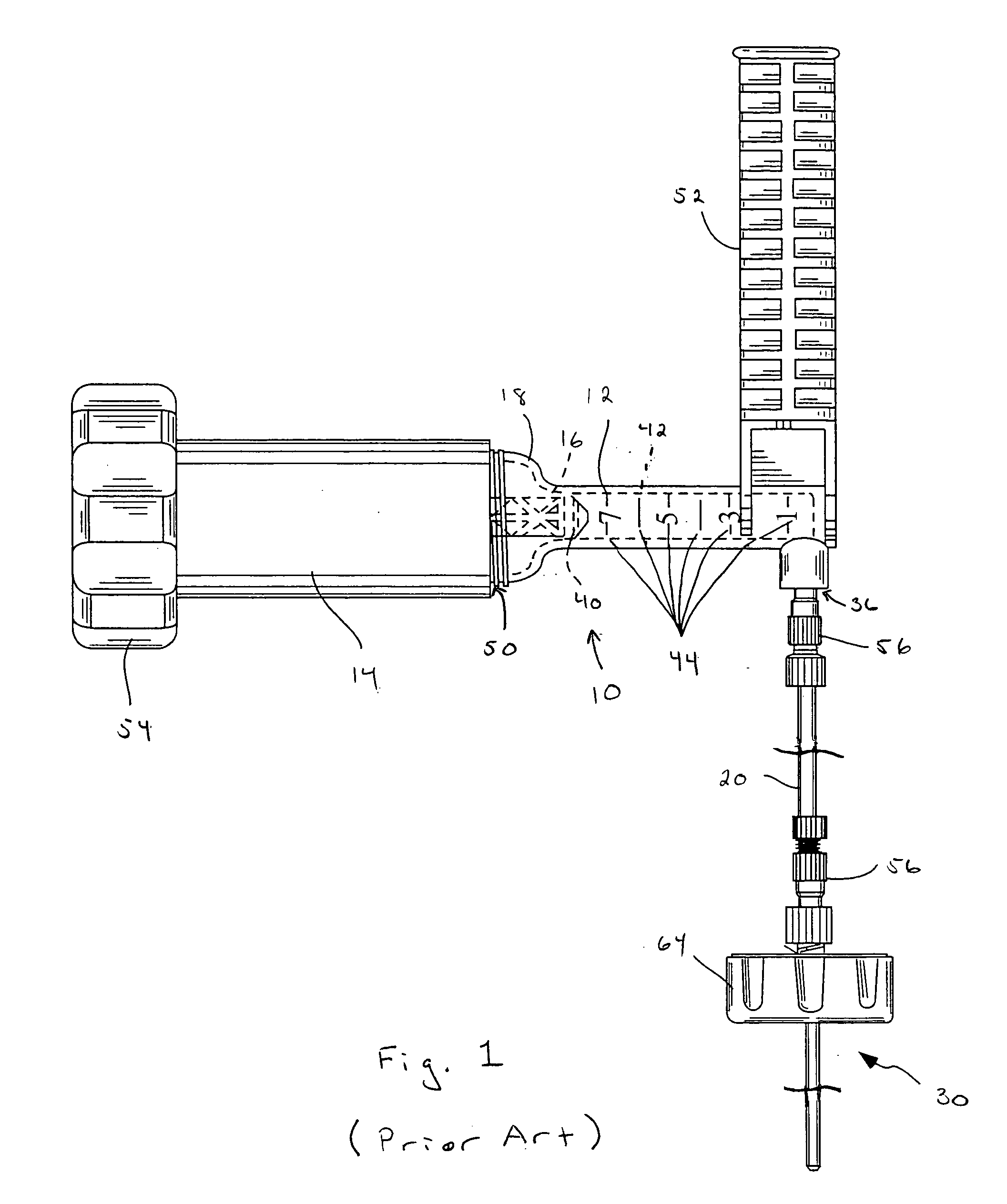 Remotely actuated system for bone cement delivery