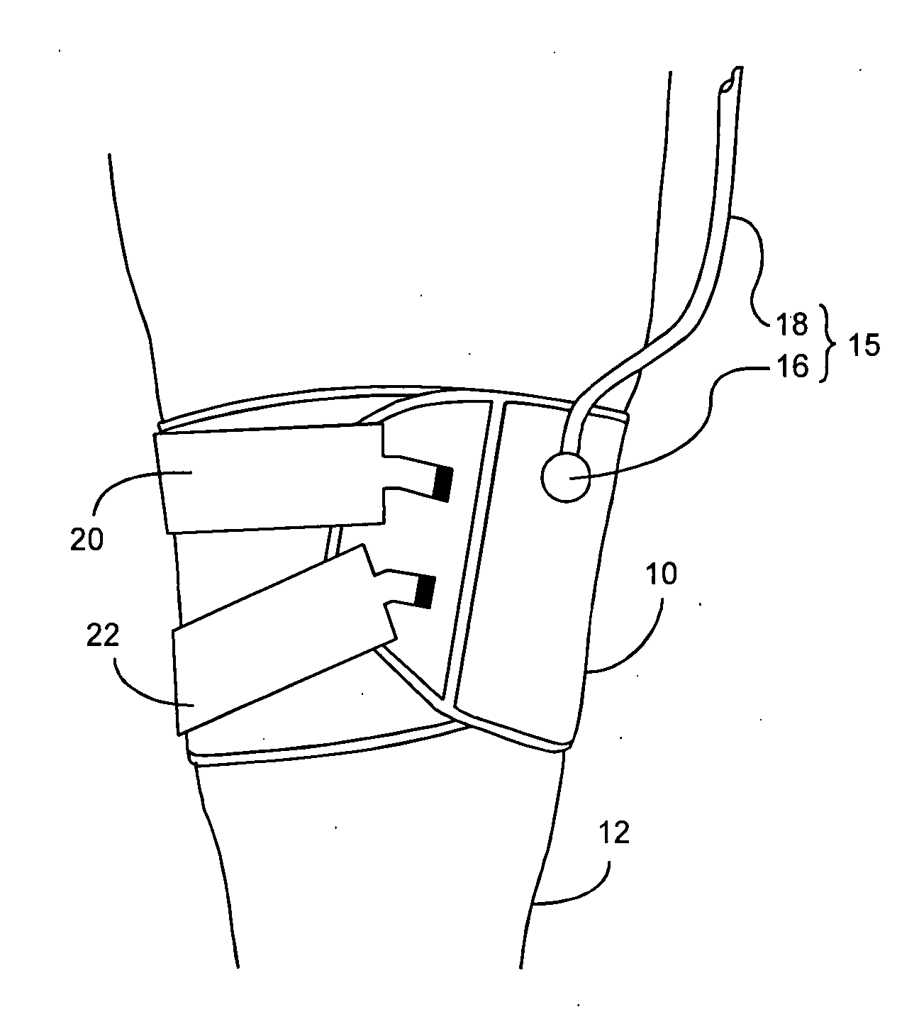 Low-cost contour cuff for surgical tourniquet systems