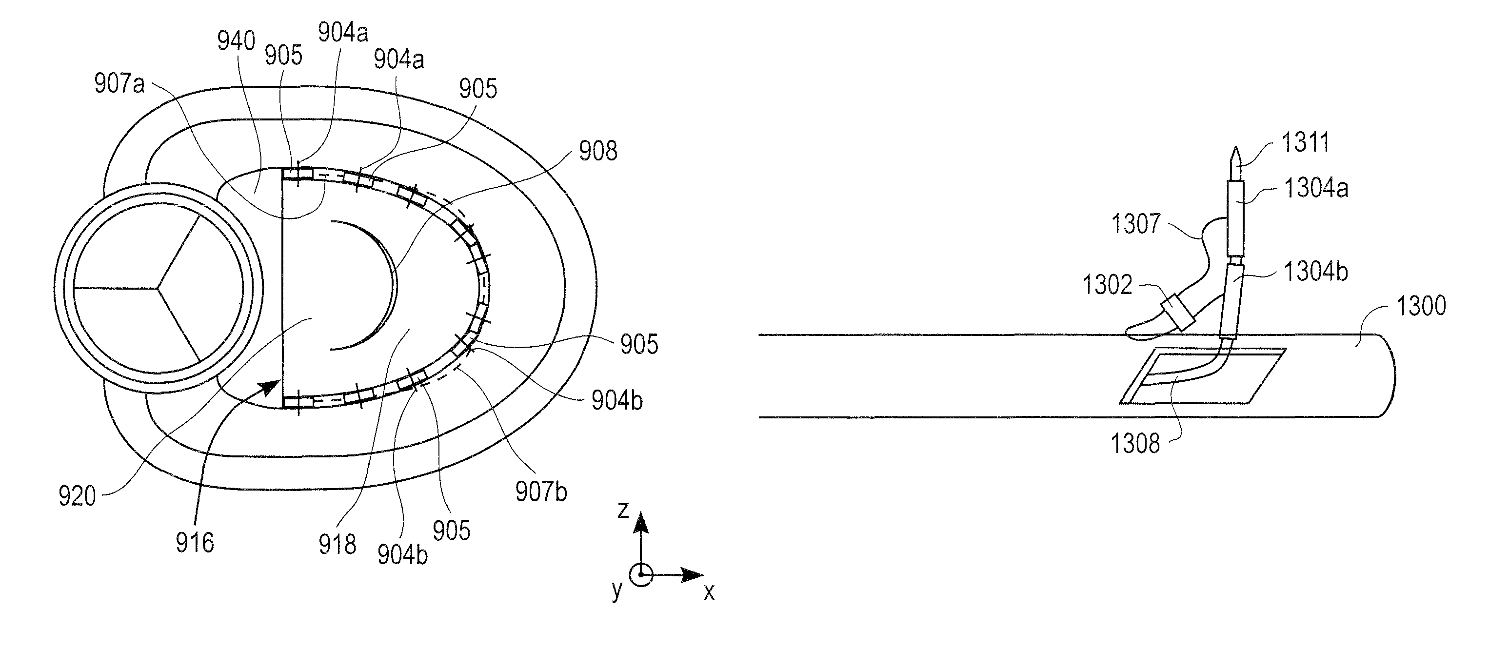 Method and apparatus for performing catheter-based annuloplasty using local plications