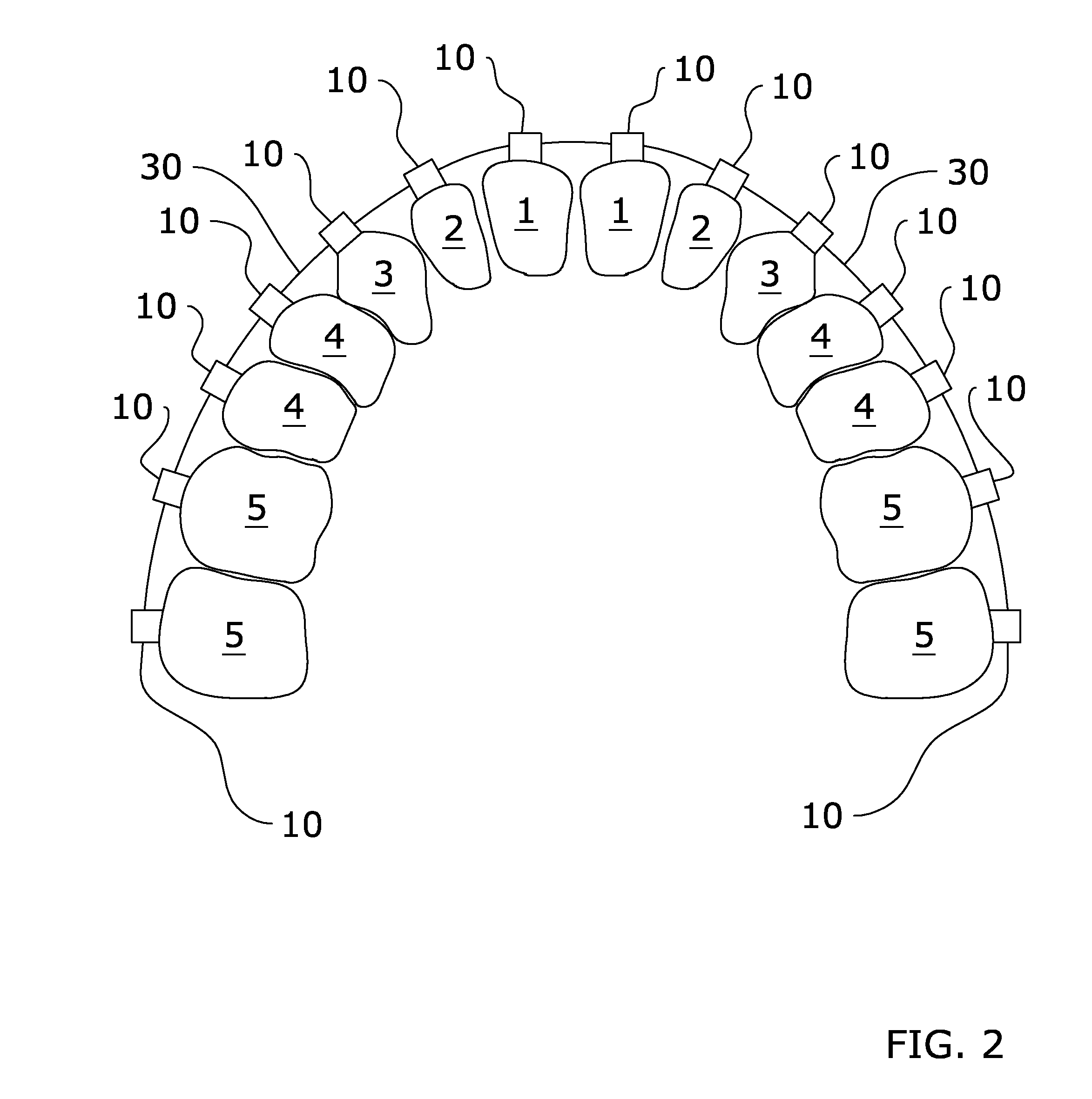 Orthodontic Appliance