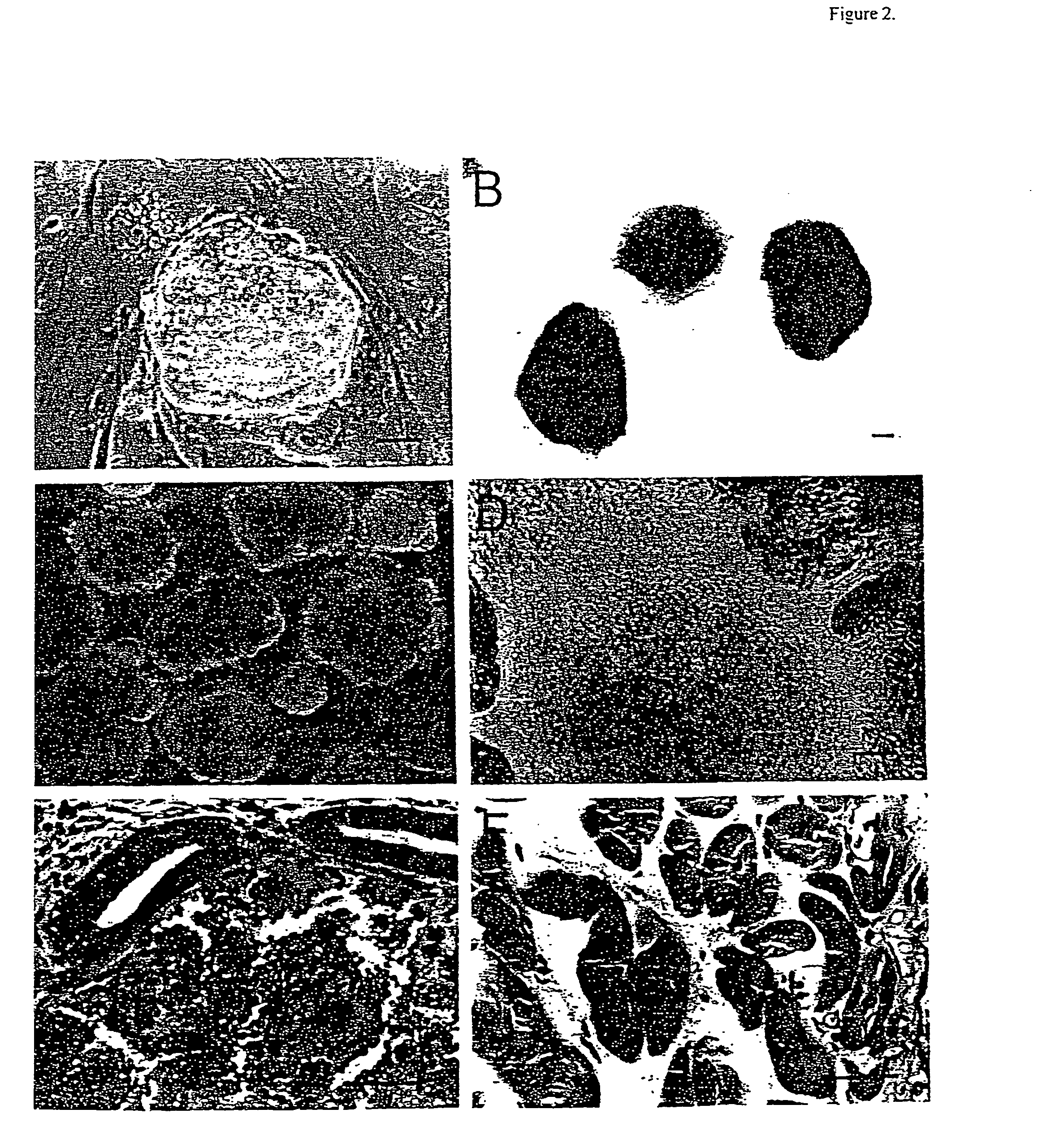 Methods for assaying gene imprinting and methylated cpg islands