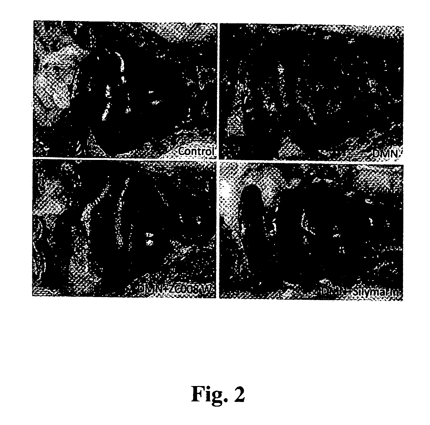 Pharmaceutical use of water-soluble fraction of graptopetalum