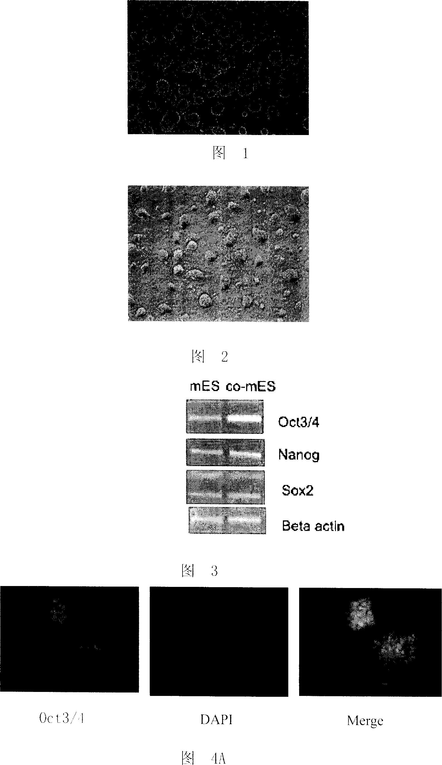 Method for culturing mouse embryo stem cell and its dedicated culture medium