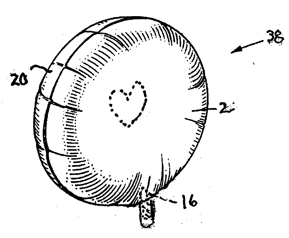 Localized sealant application in aerostats