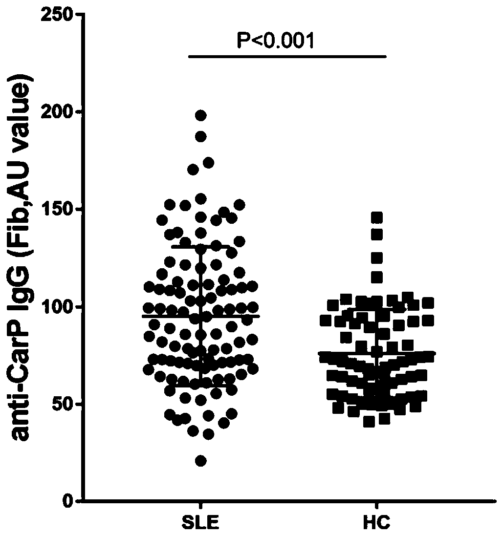 Application of anti-CarP (Carbamylated protein) antibodies as systemic lupus erythematosus (SLE) diagnostic marker