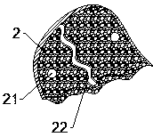 Mandible reduction device