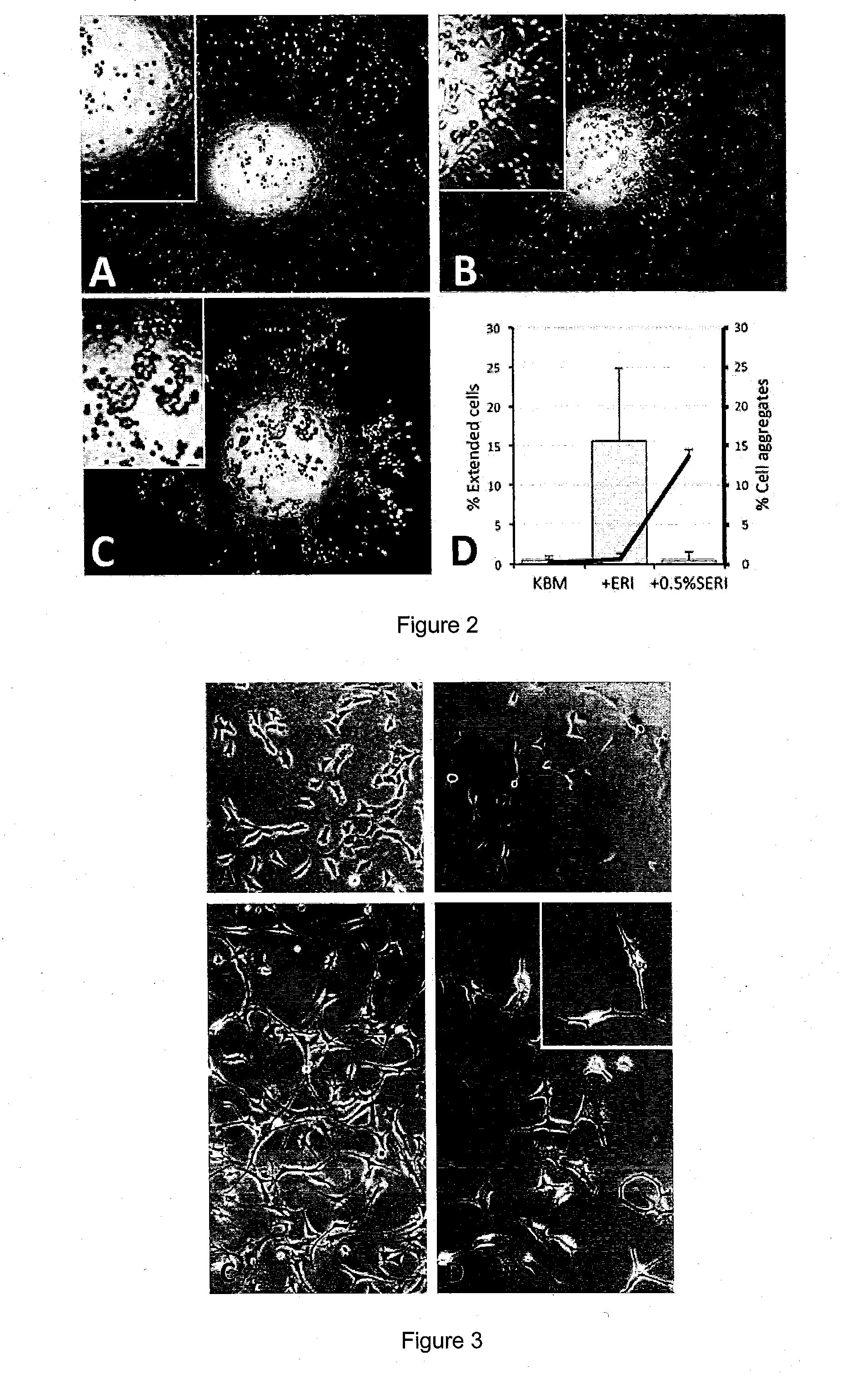 Corneal stromal keratocyte culture