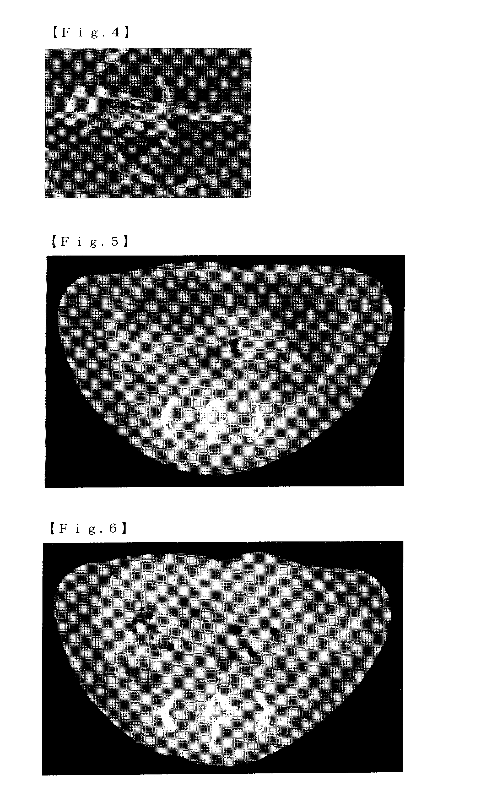 Mixture, Dissolving Solution and Pharmaceutical Agent Each Comprising Thermophilic Microorganism