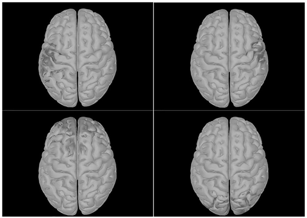 Motor imagery classification method based on electroencephalogram traceability and dipole selection