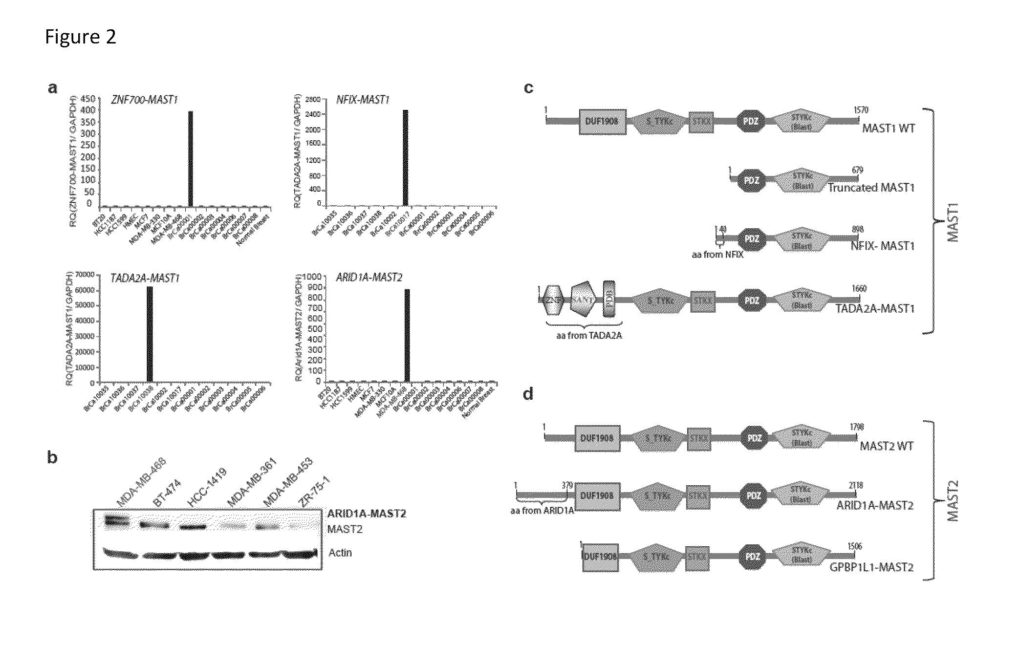 Recurrent gene fusions in breast cancer