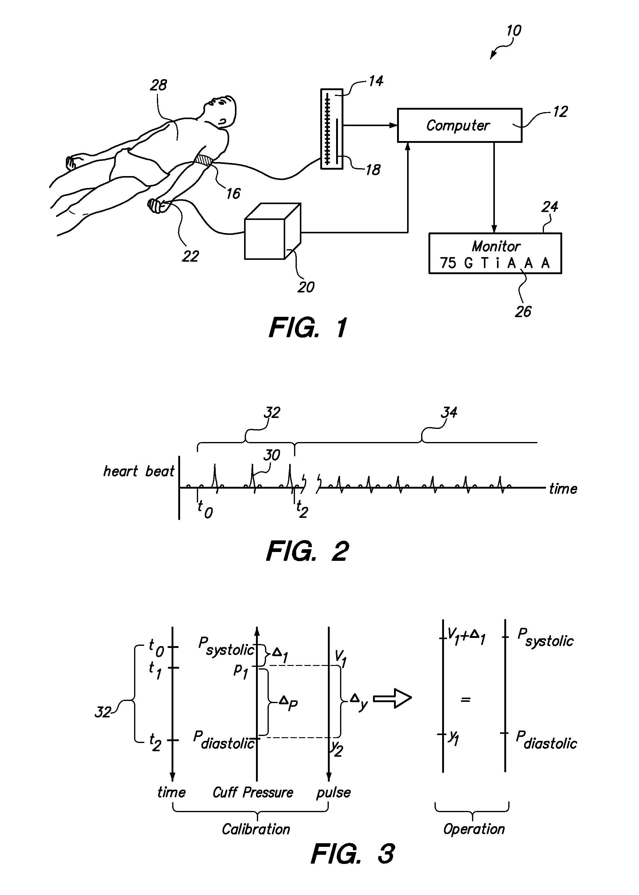 Method for Using a Pulse Oximetry Signal to Monitor Blood Pressure