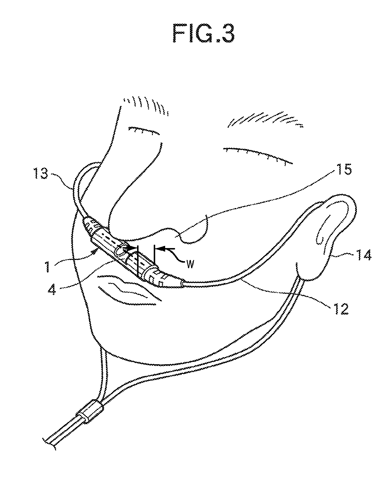 Sensor for measuring carbon dioxide in respiratory gas