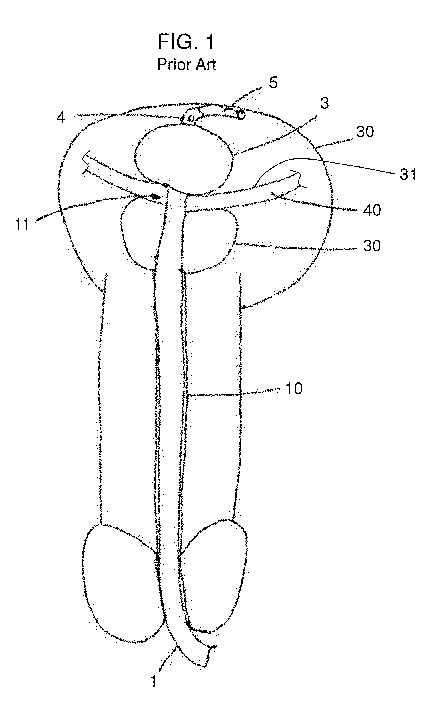Stretch Valve Balloon Catheter and Methods for Producing and Using Same