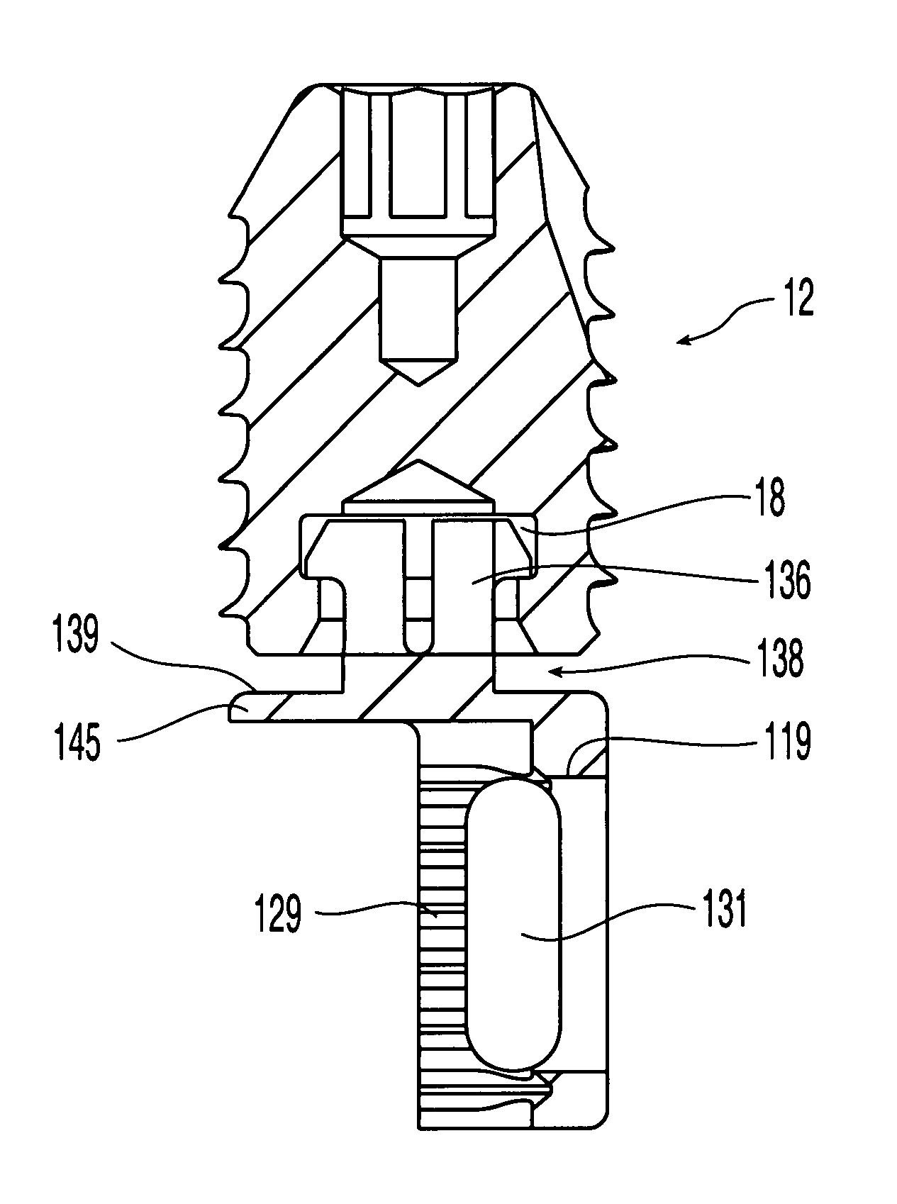 Graft fixation system and method