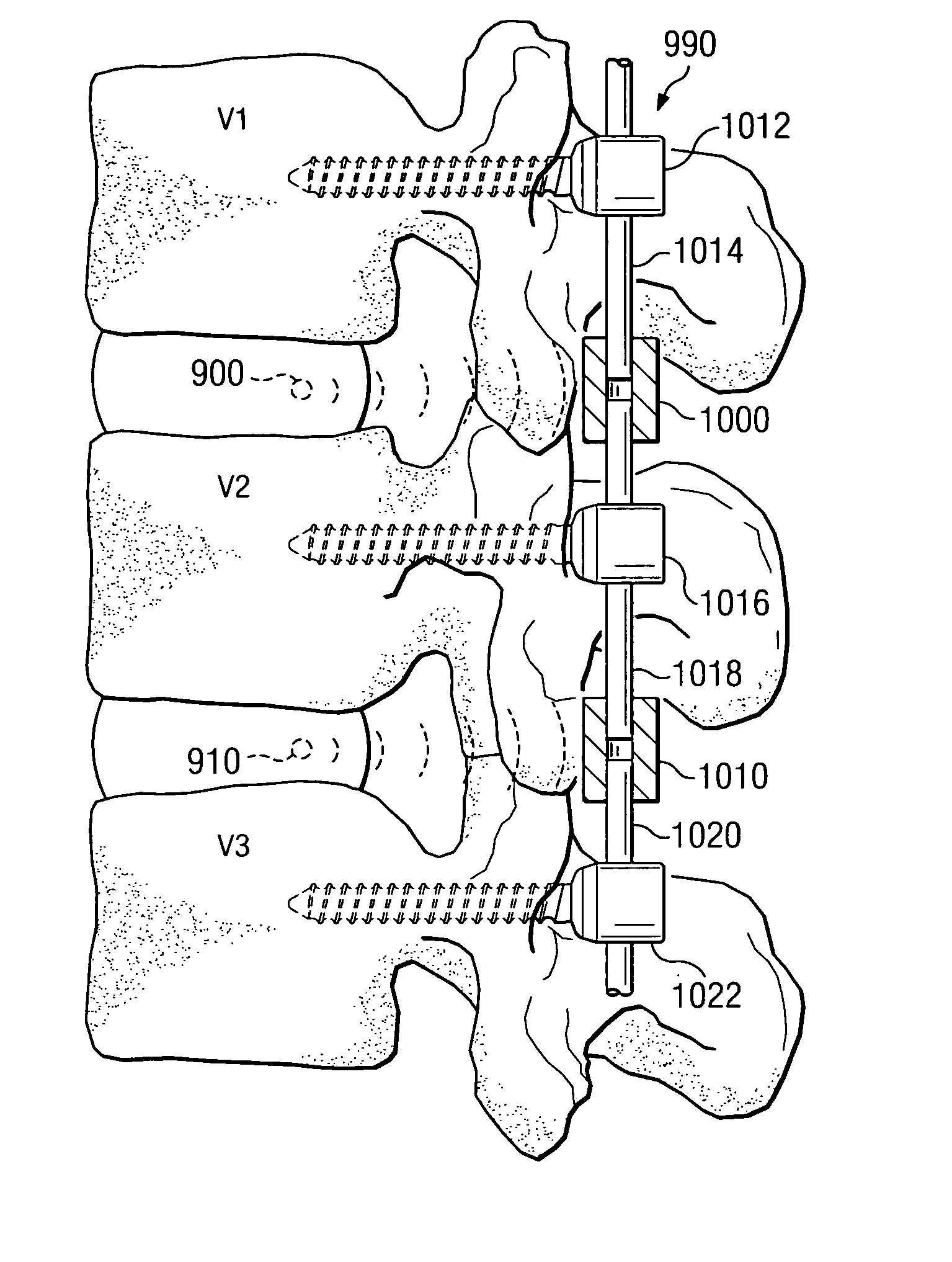Dynamic treatment system and method of use