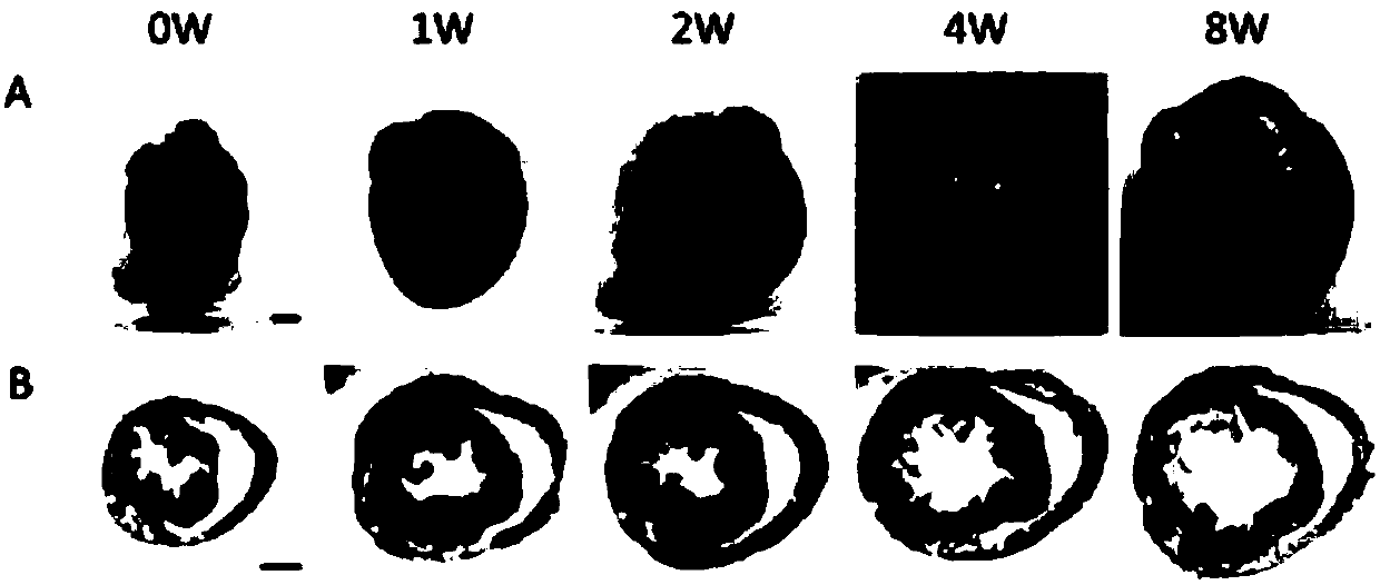 Method for establishing mouse model of cardiac volume overload