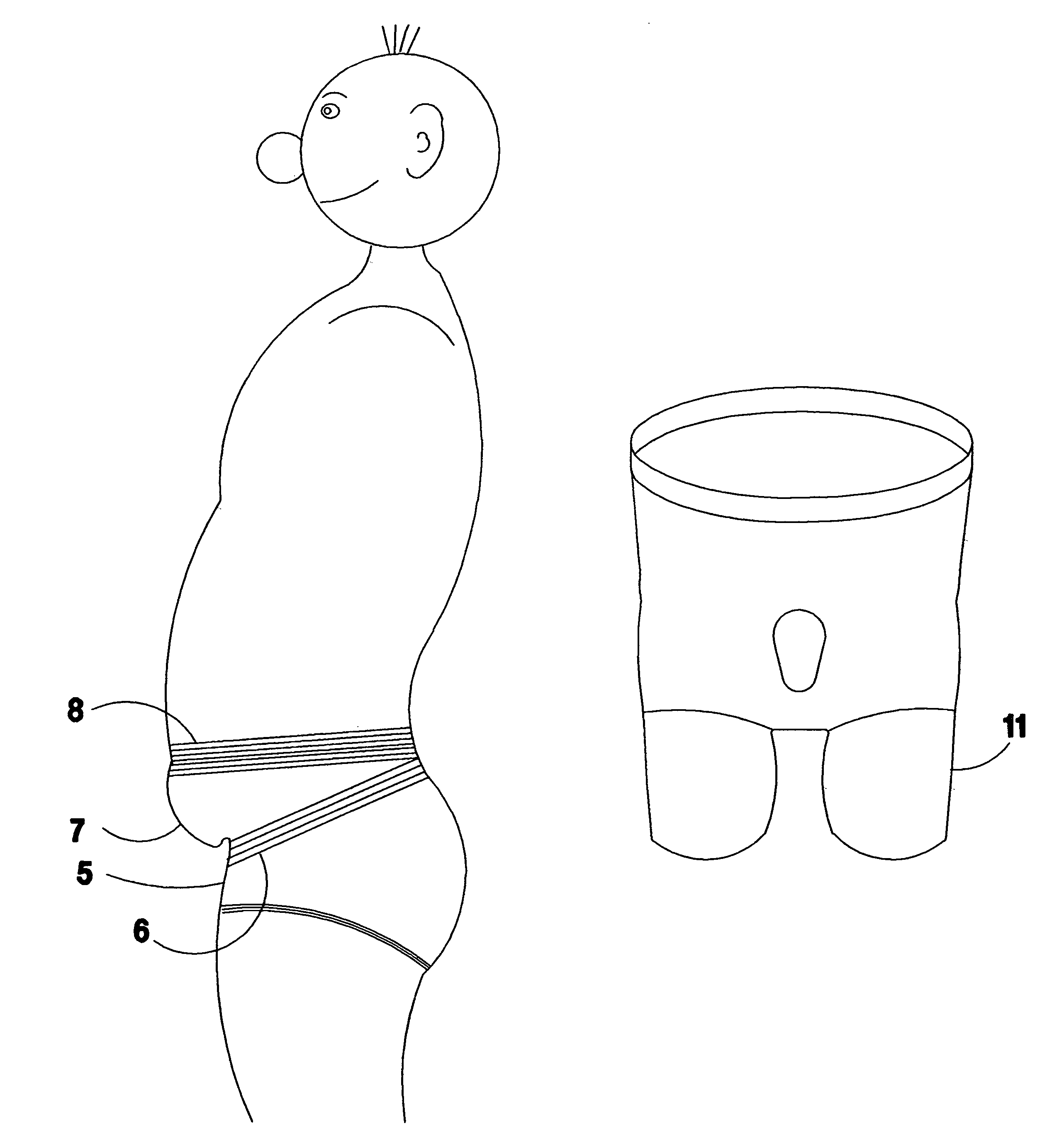 Undergarment for hernia relief and other purposes